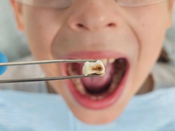 Best Emergency Care for Gum Disease in Camp Barrett, VA